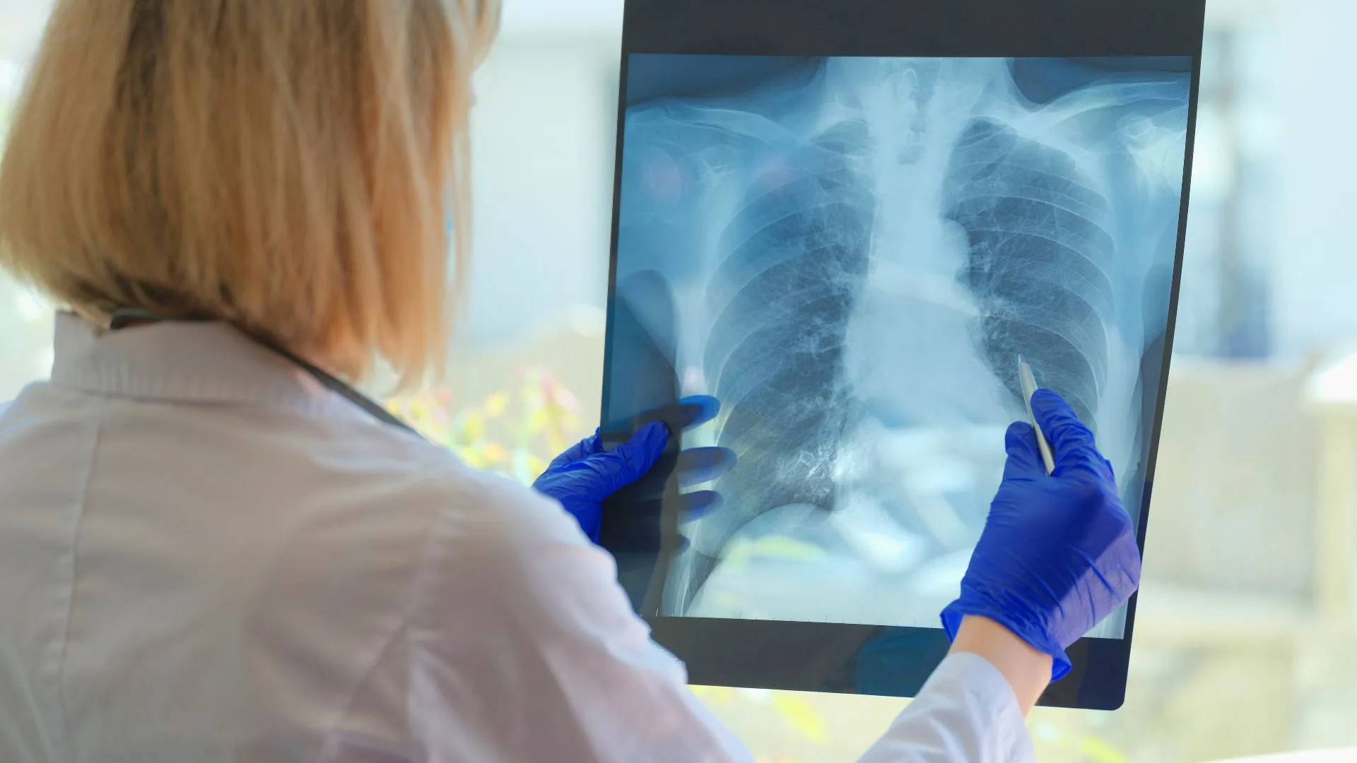 Cardiopulmonary Physiotherapy