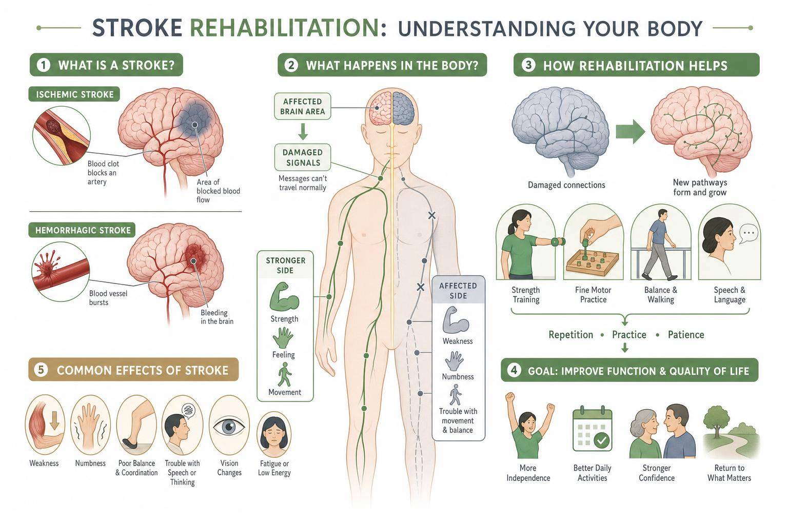Labeled medical diagram explaining the anatomy of stroke rehabilitation